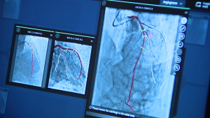 Read more about the article Bay Section clinic the usage of AI generation for pristine cardiac process – FOX 13 Tampa